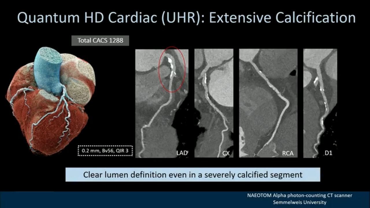 Cardiac and Vascular Imaging - Cardiac - Western University