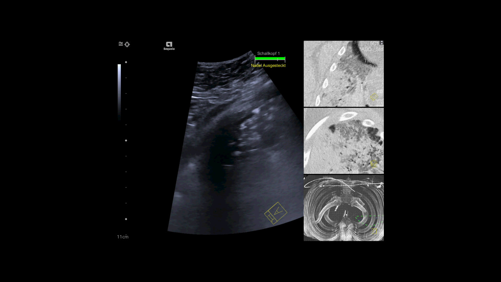 Real-Time B-Mode Ultrasound