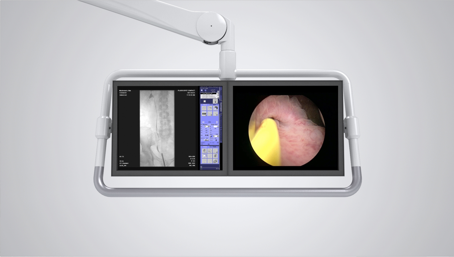 Uroskop Omnia Max - Siemens Healthineers Japan