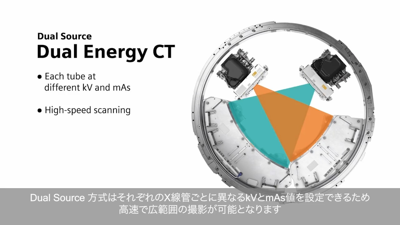 X線CT装置デュアルソースCT - Siemens Healthineers Japan