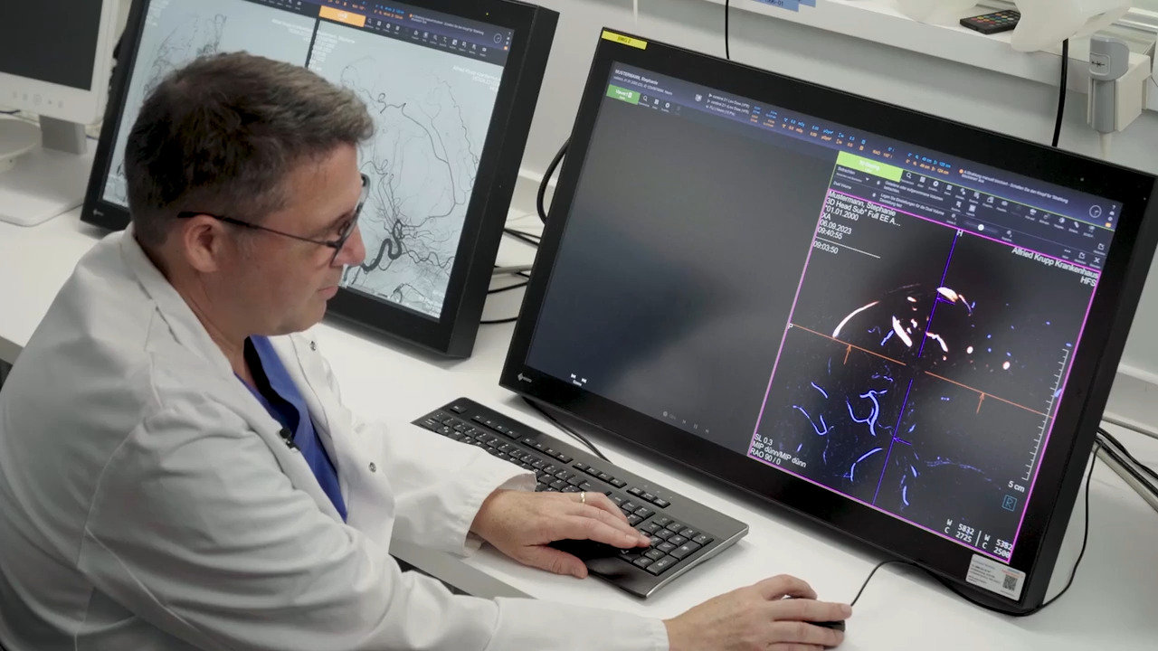 健康・医学 Interventional Neuroradiology Interventional Neuroradiology – Los Angeles, CA | Cedars-Sinai