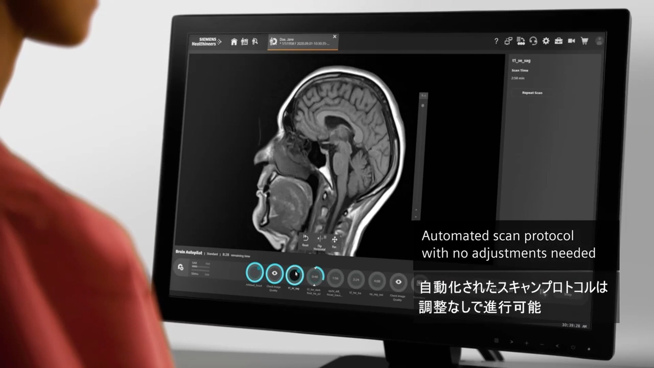 MAGNETOM Free.Star - 1.5Tに匹敵する高画質を地域医療へ - Siemens