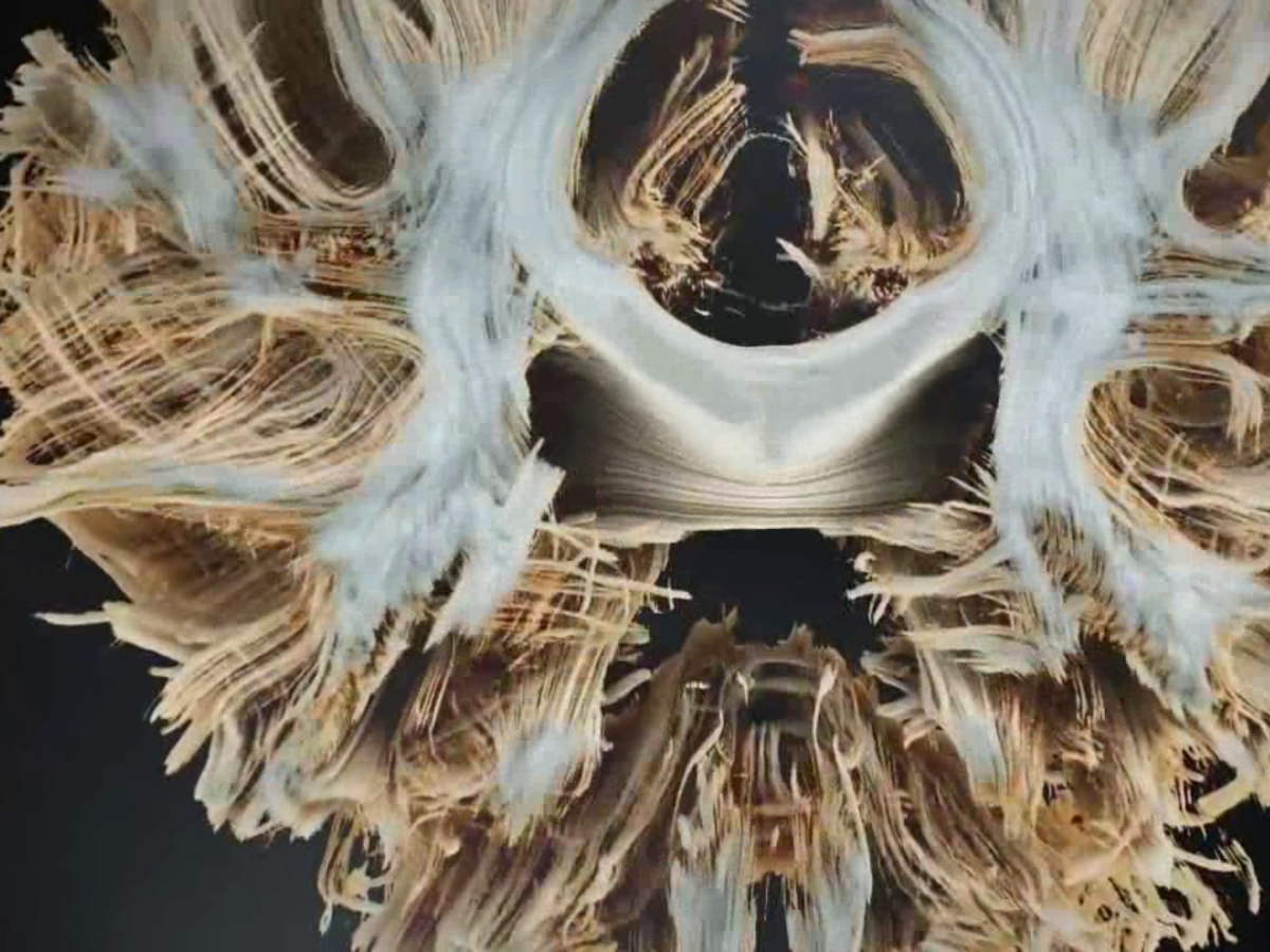 MAGNETOM Terra – 7T MRI Scanner - Siemens Healthineers Türkiye