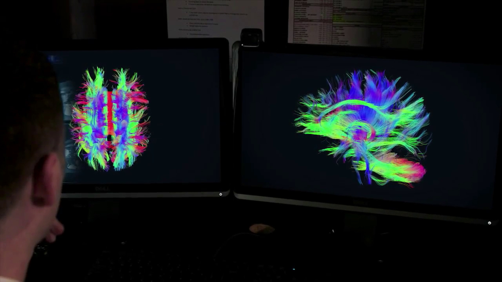 MR Neuro Imaging - MRI Neurology - Siemens Healthineers USA