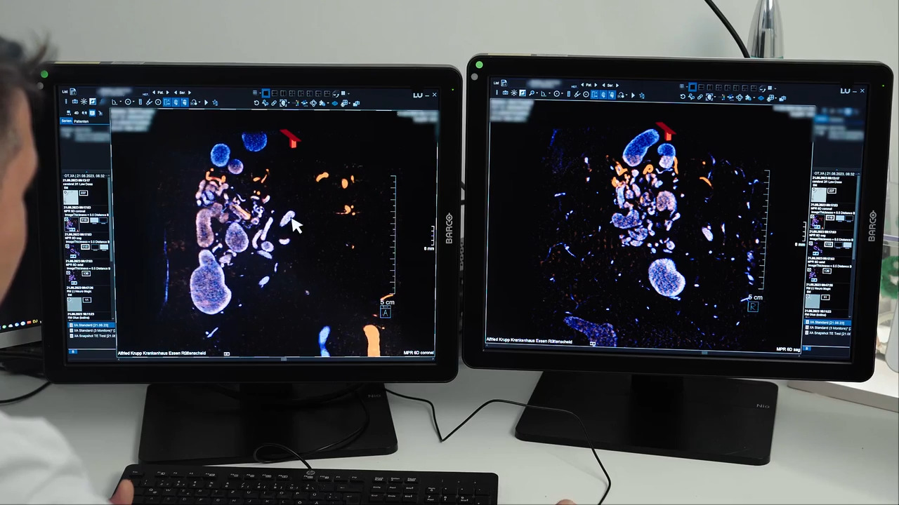 健康・医学 Interventional Neuroradiology Interventional Neuroradiology – Los Angeles, CA | Cedars-Sinai