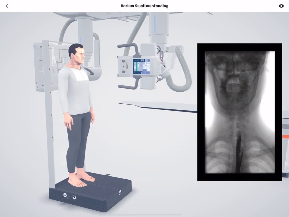 Robotic X-Ray - Clinical Workflows - Siemens Healthineers USA