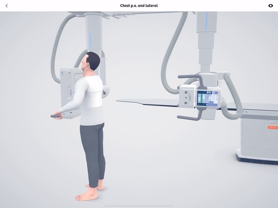 Robotic X-Ray - Clinical Workflows - Siemens Healthineers USA