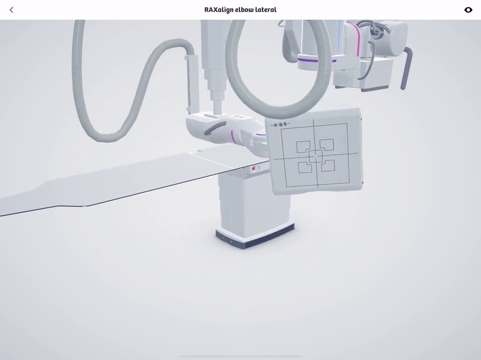 Robotic X-Ray - Clinical Workflows - Siemens Healthineers