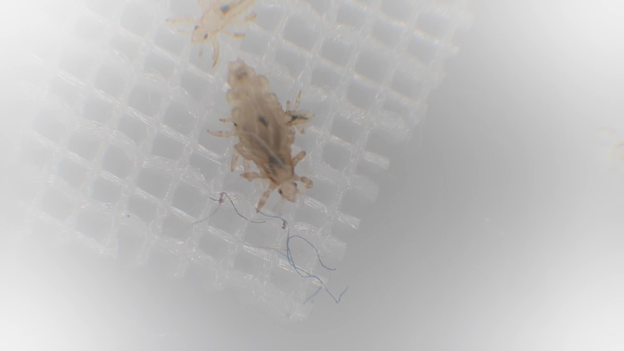 Parents Warned Over New Breed Of Super Head Lice Resistant To