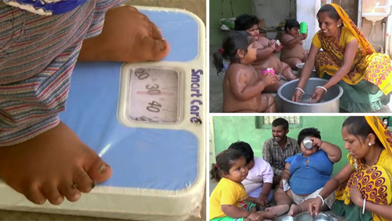Obese Indian Kids Who Had Lifechanging Weight Loss Operation Paid For By Online Donors Are Now Bigger Than Ever After Treatment Failed
