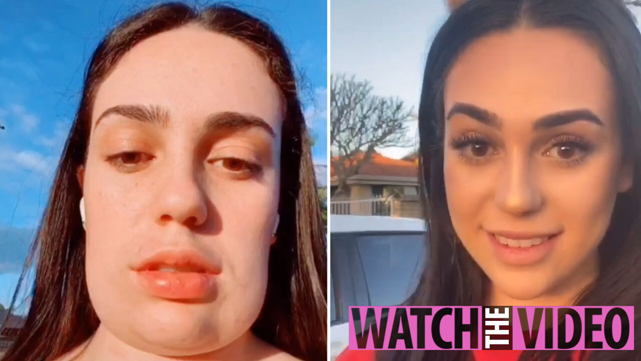 Teen Who Ended Up With A Square Head After Chin Fat Removal Surgery Shows Off Her Final Look Eights Weeks Later