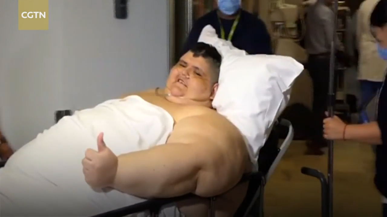 World S Fattest Man Juan Pedro Franco Who Tipped Scales At 93st Recovers After Second Weight Loss Op