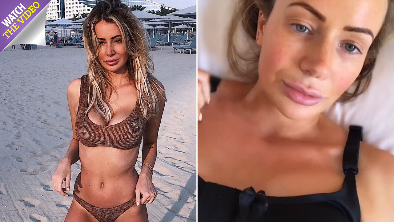 Holly Hagan reveals boob reduction plans – set to remove famous FF implants  - Daily Star