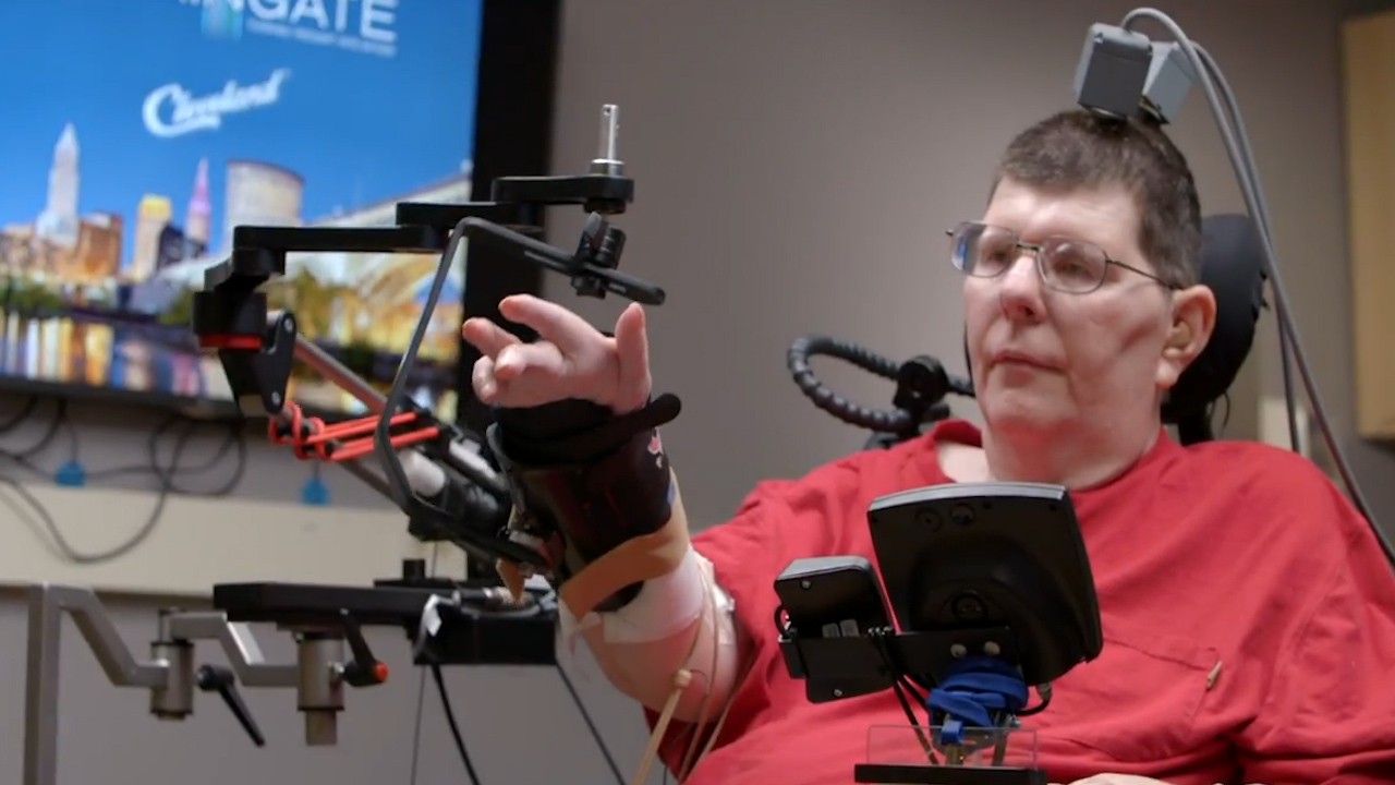 Normalisatie kubiek neef Quadriplegic man can move his arm again - just by THINKING - thanks to  miracle implant 'cure' for paralysis