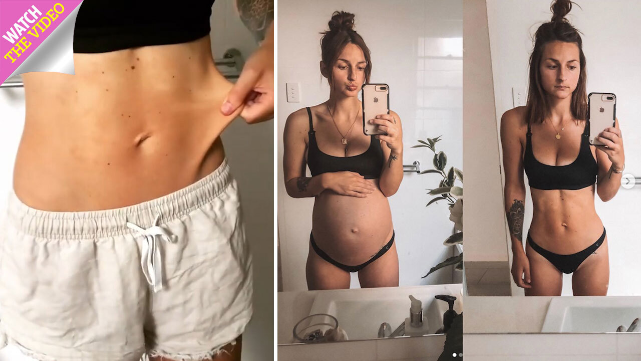 12 Weeks Post Op from excess skin - Transforming Noelle