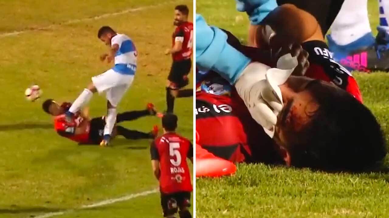 Soccer player kicked in head Clearance