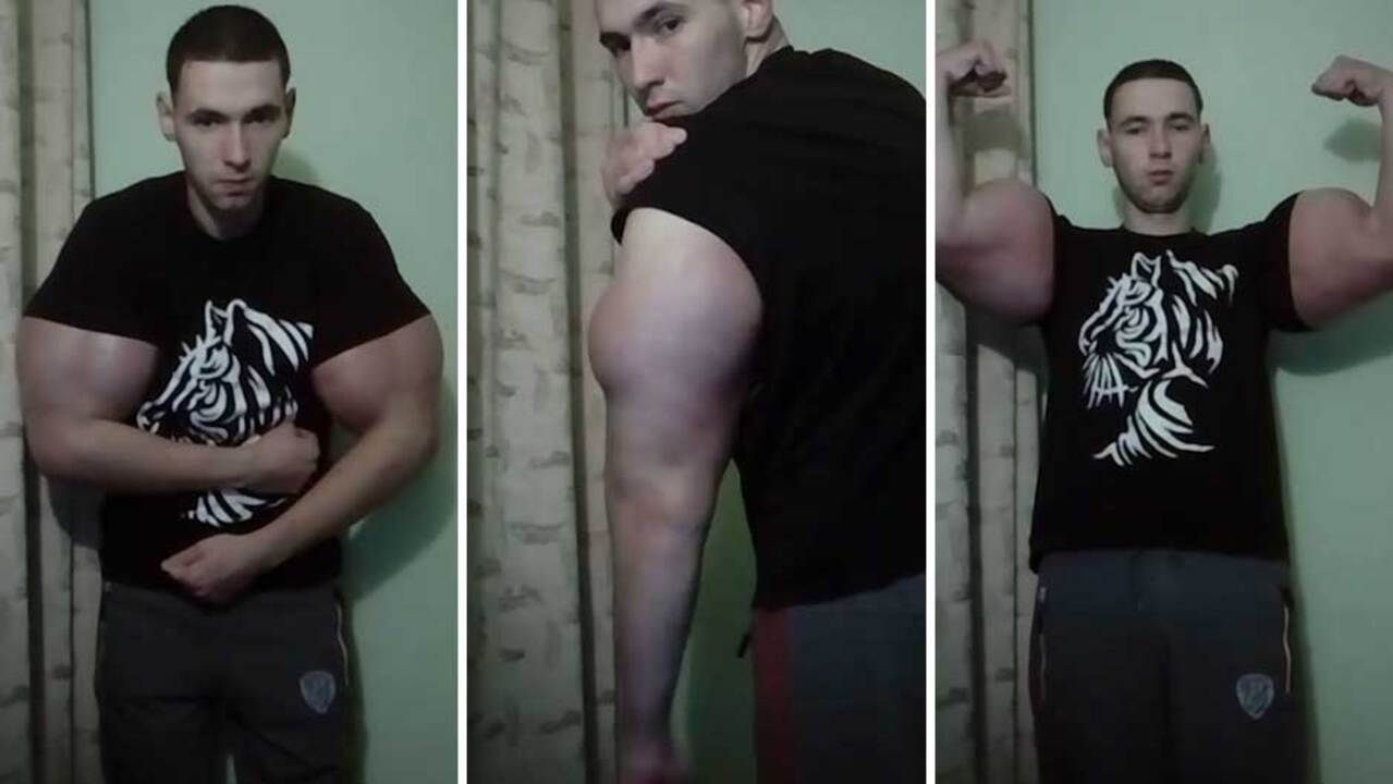 Brazilians Hulk and Conan get 28in biceps with drugs