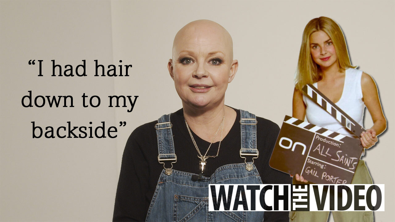 When I lost my hair to alopecia 20 years ago I said I'd never do a