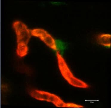 Un macrófago (verde) junta los extremos rotos de un vaso sanguíneo del cerebro (rojo)