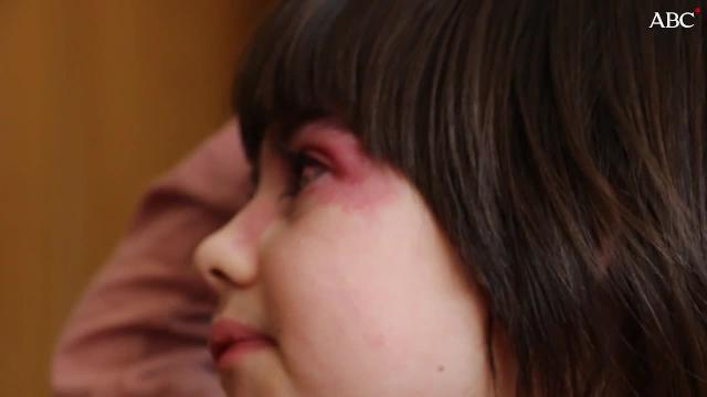 Vídeo: Las historias de Leire y Noa, dos niñas con enfermedades raras.