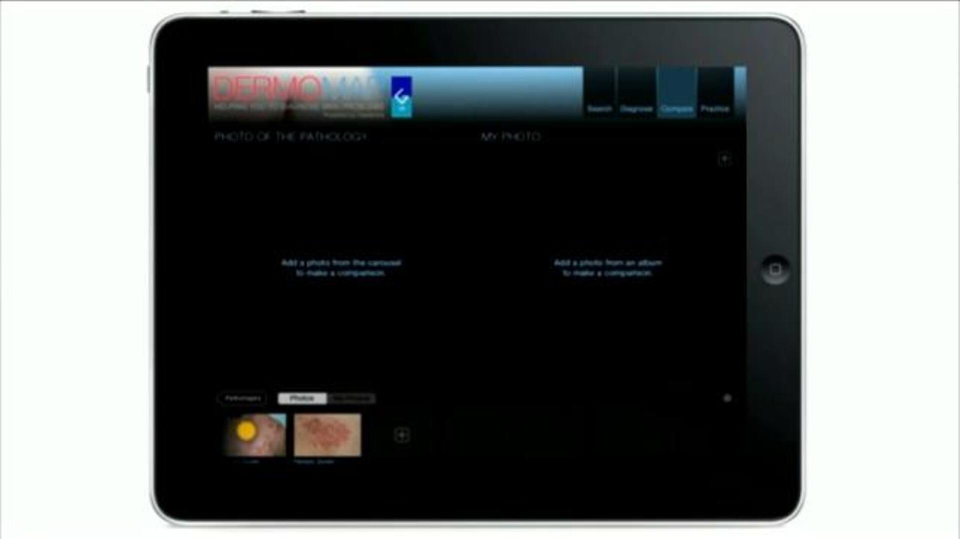 Nace la primera aplicación para iPad que ayuda a diagnosticar problemas de piel