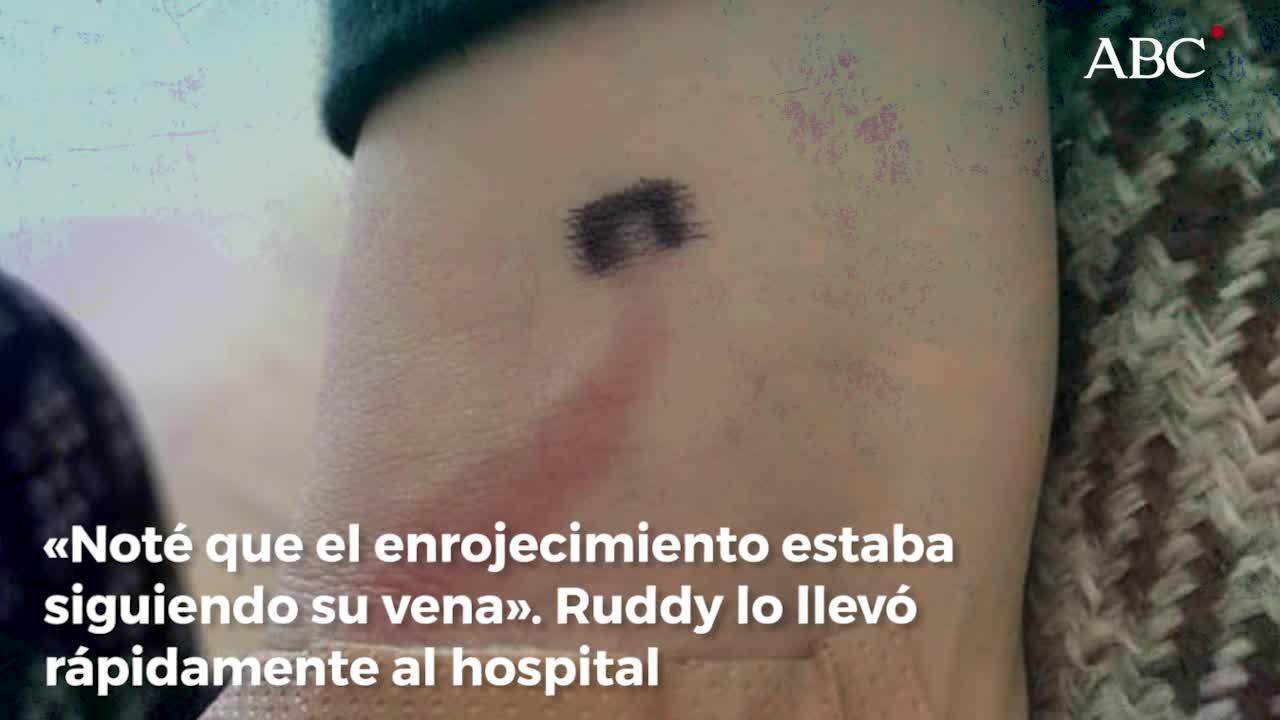 La enfermedad que mata cada año a más personas que el cáncer de intestino y el de mama juntos