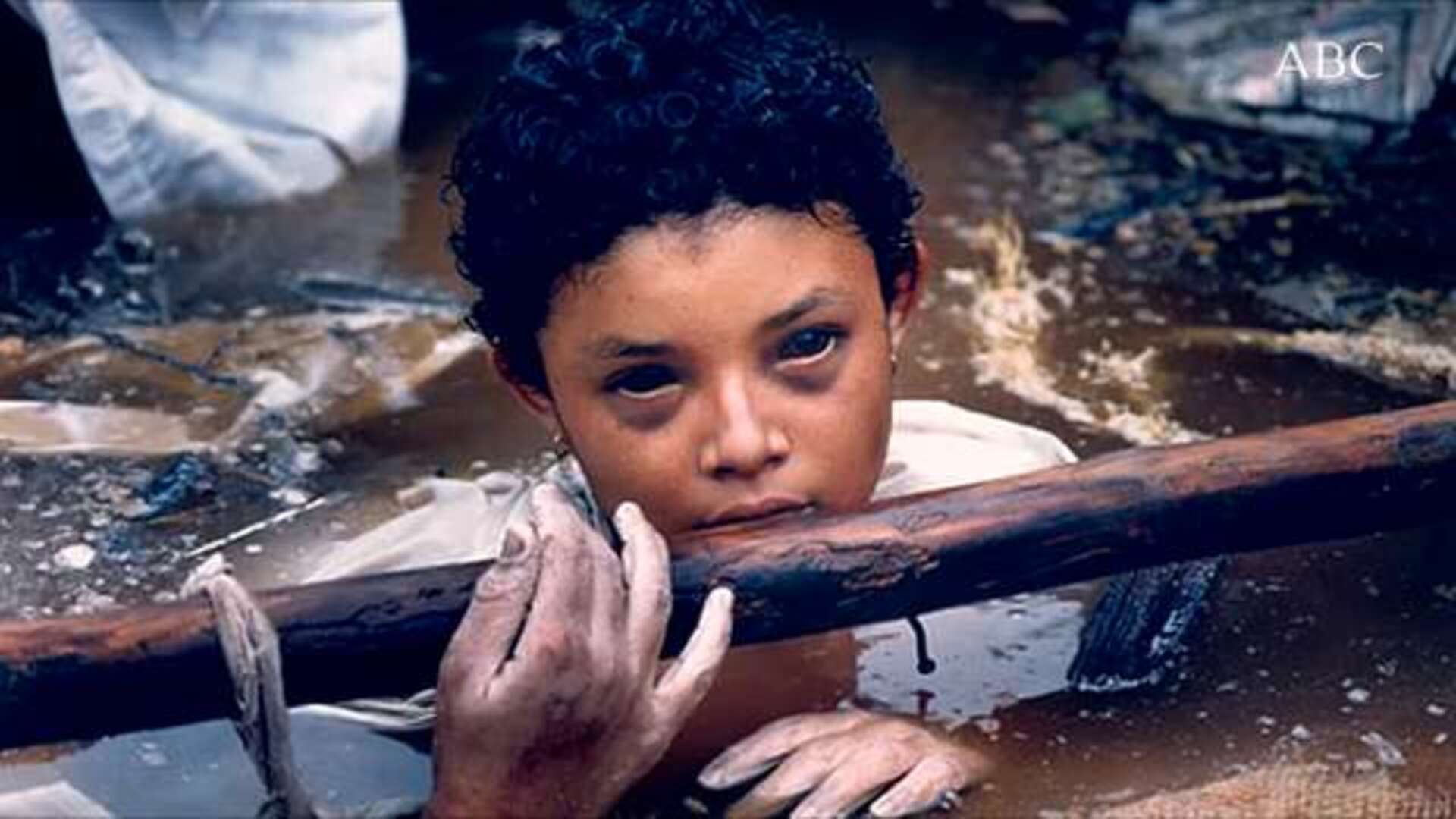 La agonía de Omaira tras la erupción del volcán Nevado Ruiz