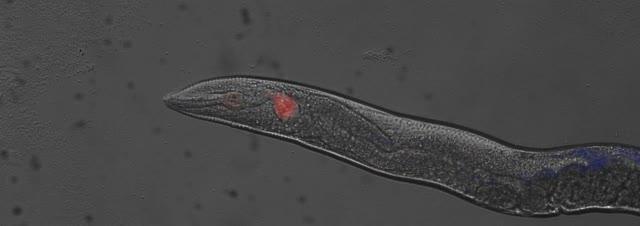 Rigor mortis en gusanos ofrece una nueva visión de la muerte