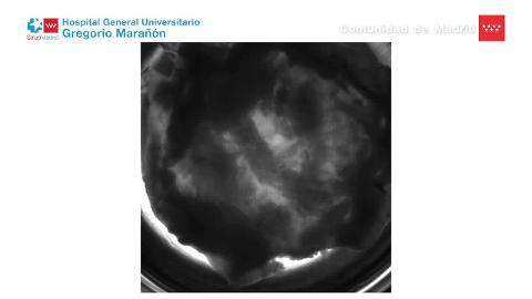 Generan injertos de corazón funcionales a partir de células madre pluripotentes humanas