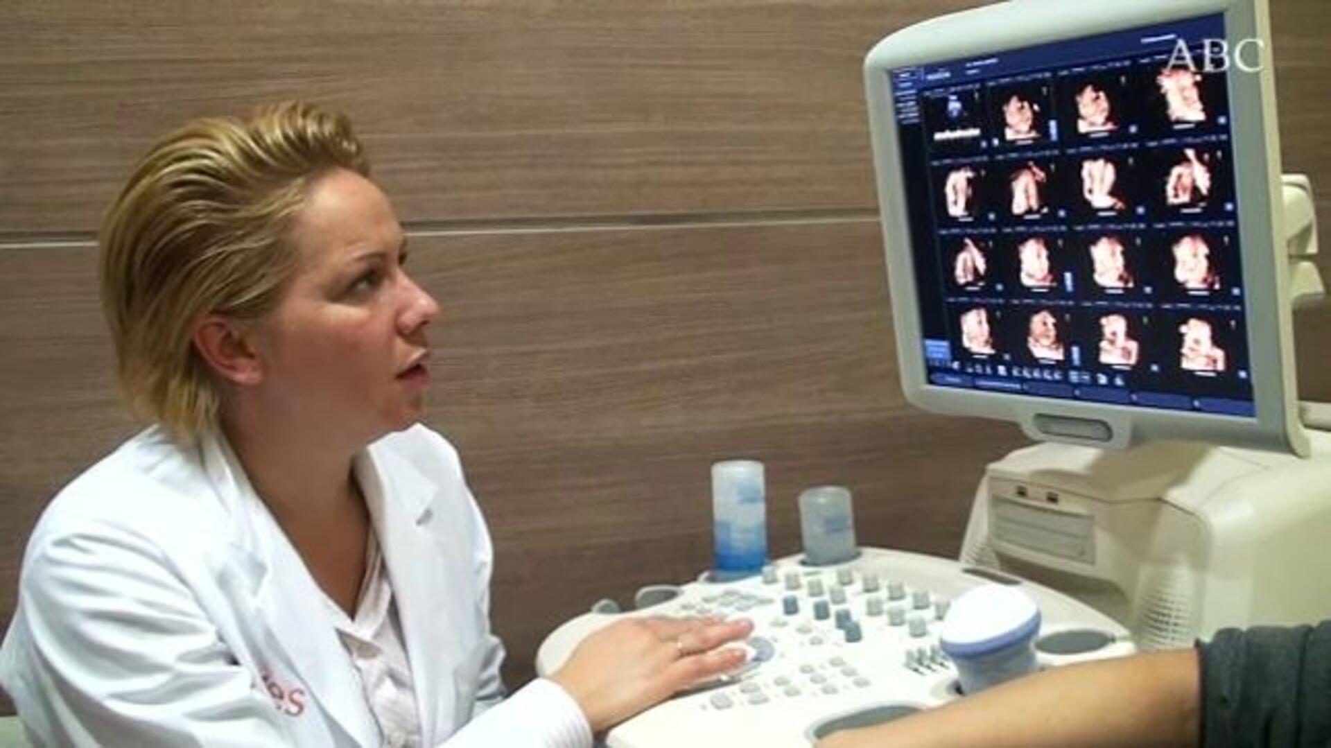 «Ver la cara de tu bebé antes de que nazca es una experiencia única»