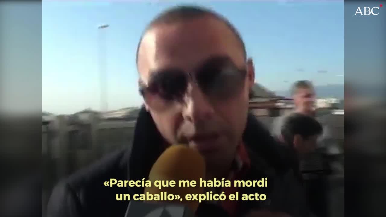 Dinio, el útlimo famosos en recurrir a los injertos de pelo