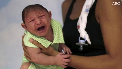 Imagen de archivo de un hombre sujetando a su bebé con microcefalia