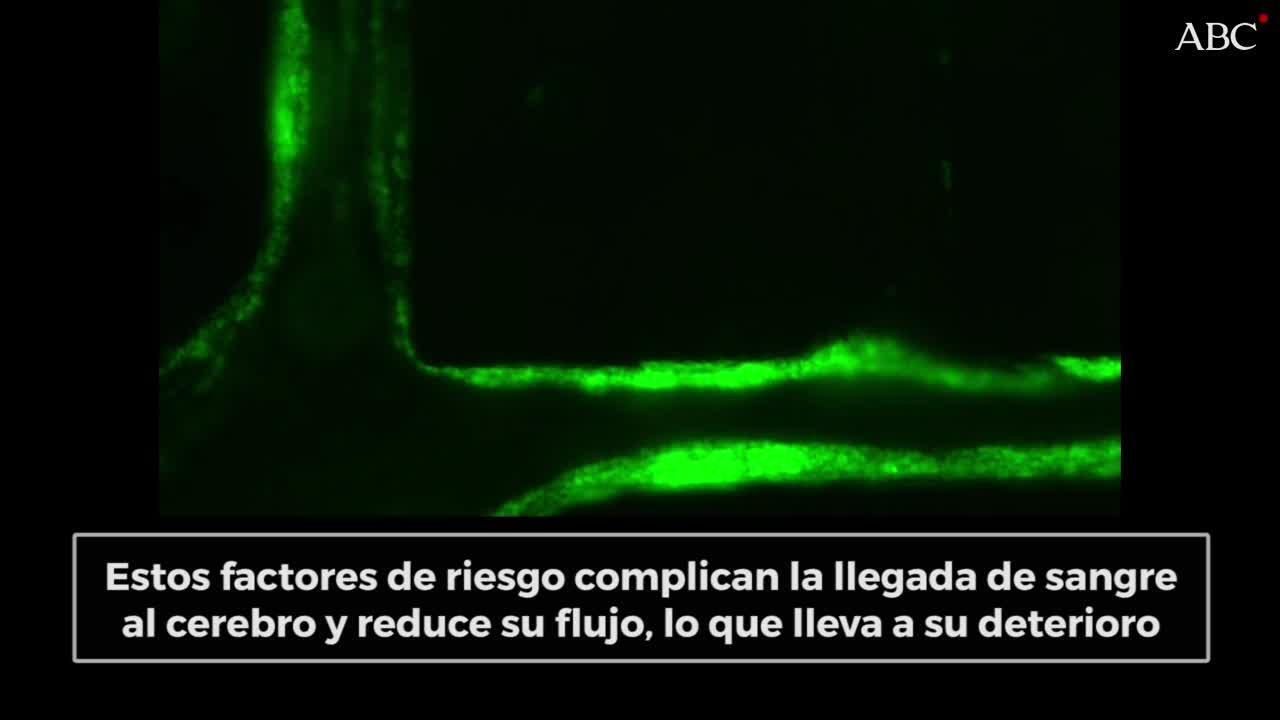 El tabaco o la obesidad influyen en el deterioro del cerebro