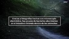Hallan pruebas de que las bacterias intestinales viven en el cerebro