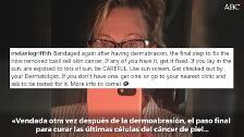 Melanie Griffith muestra el efecto del cáncer de piel en su nariz