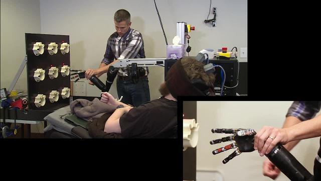 Nathan con su mano robótica