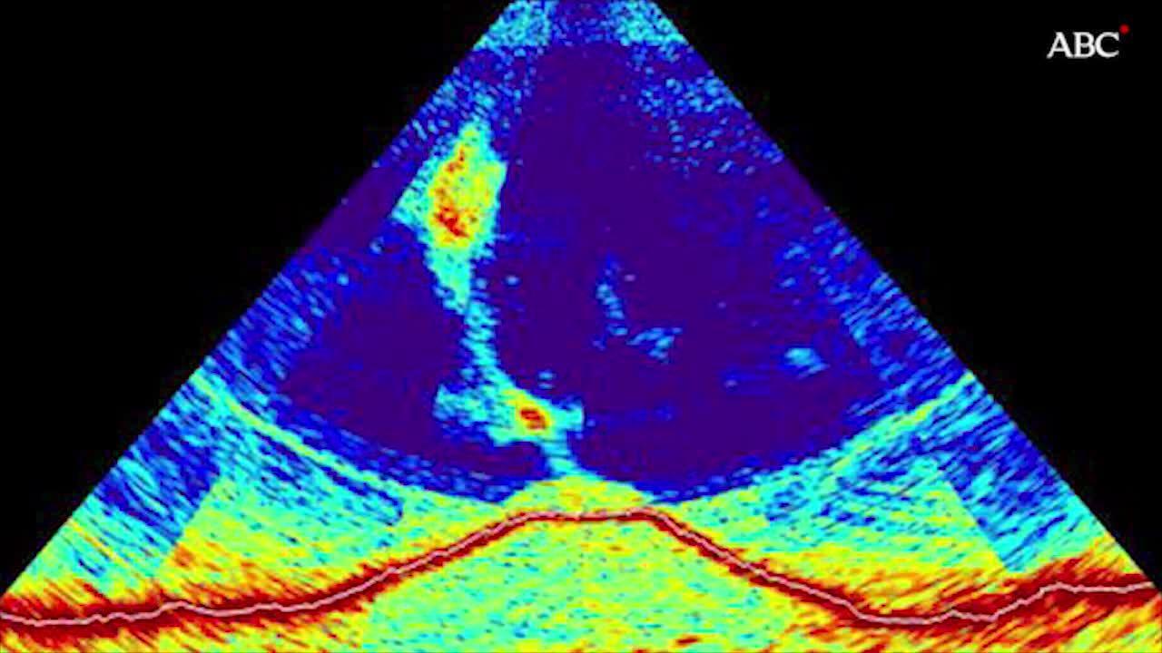 La fuerte erupción submarina nunca vista estalla en el Índico