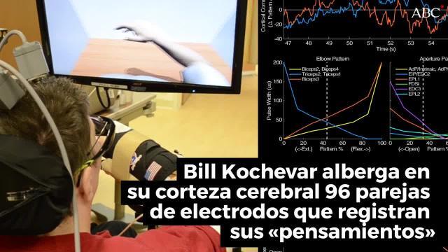 El dispositivo permite a Bill Kochavar comer sin la ayuda de su cuidador