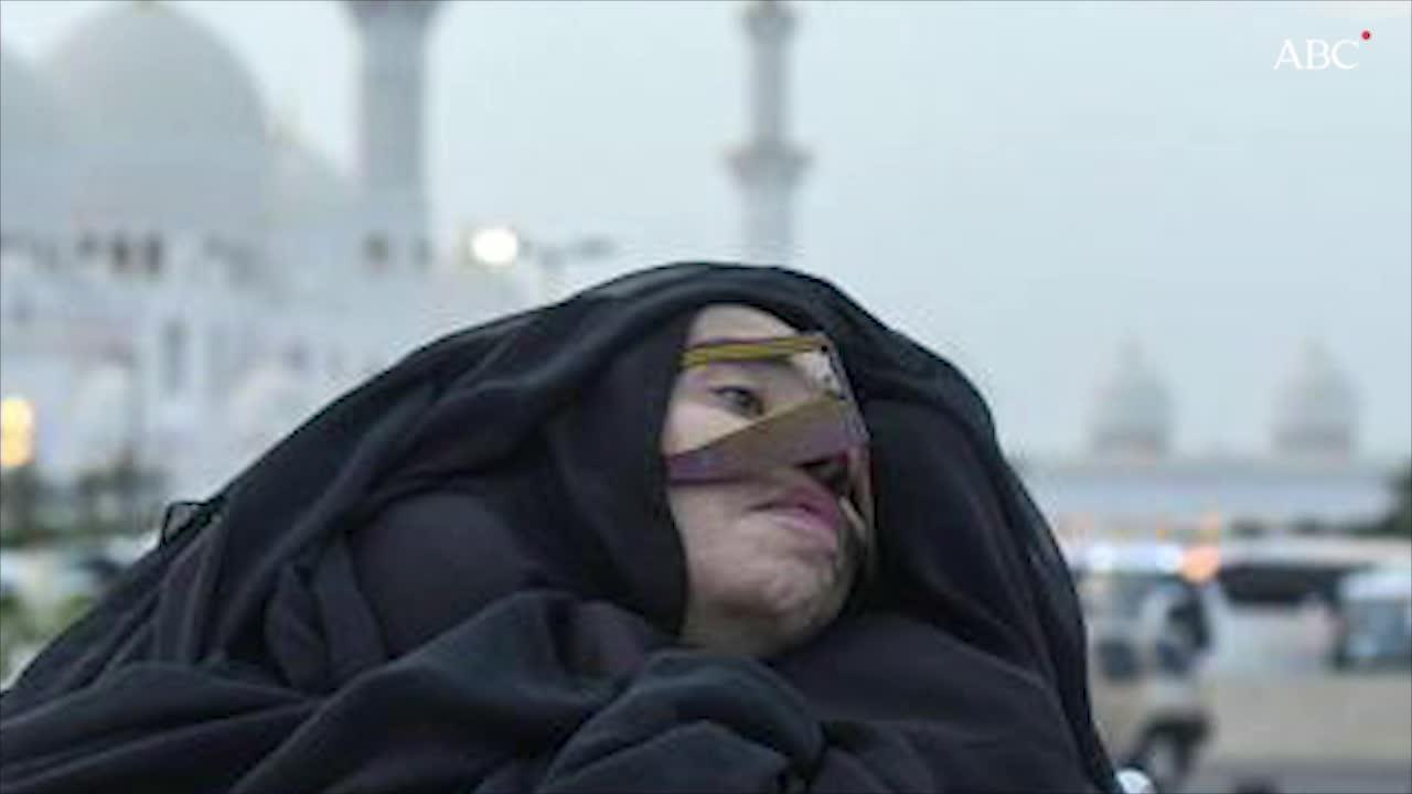 Se despierta una mujer que quedó en coma por un accidente en 1991