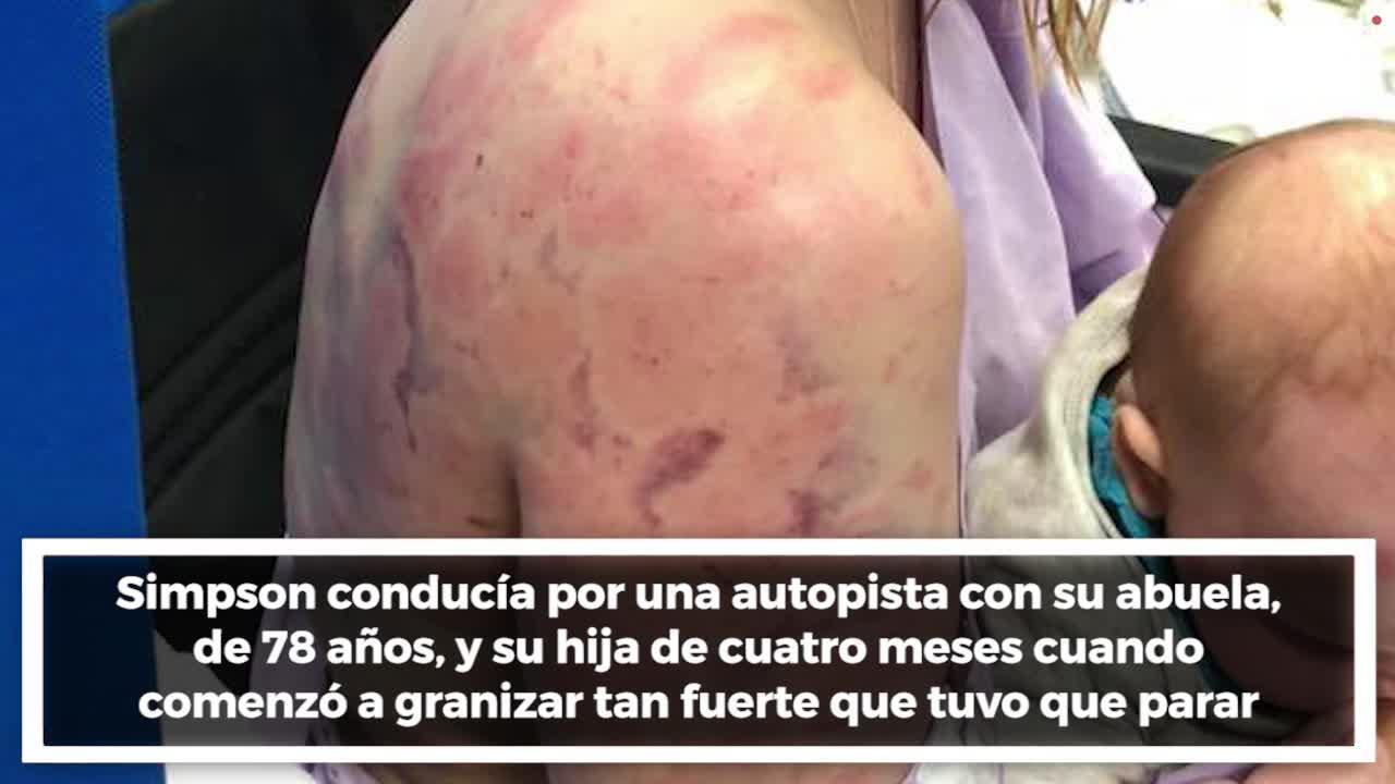 Así quedó el cuerpo de una mujer tras una tormenta de granizo