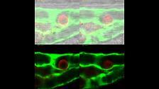 El flujo sanguíneo es esencial para la metátasis en el cáncer