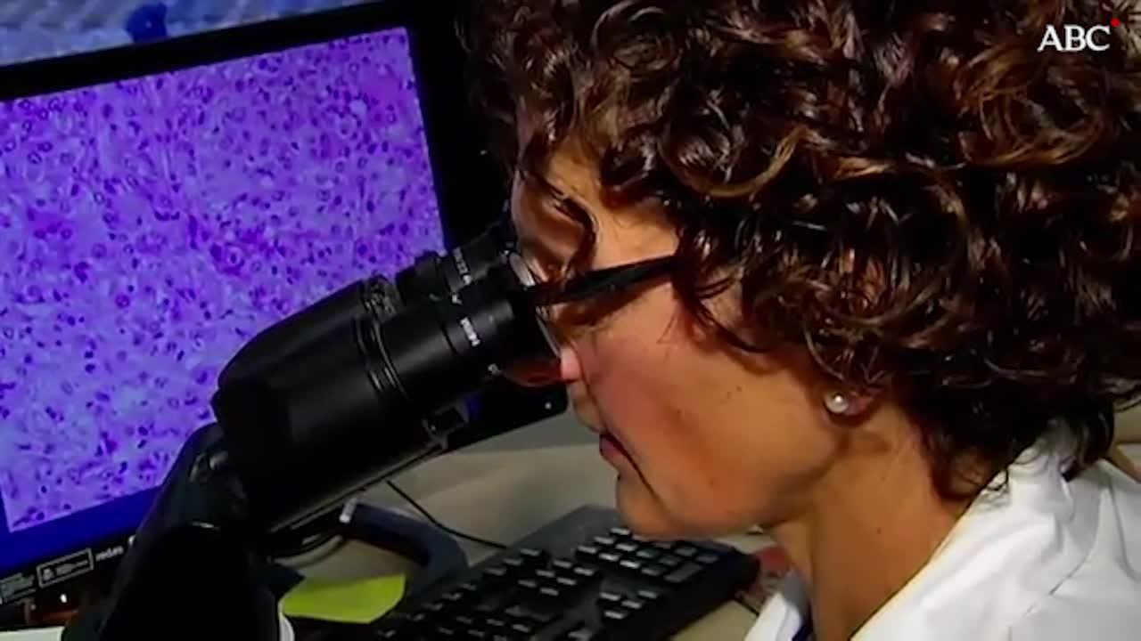 Investigan como eliminar un tipo muy agresivo de cáncer de páncreas en modelos animales