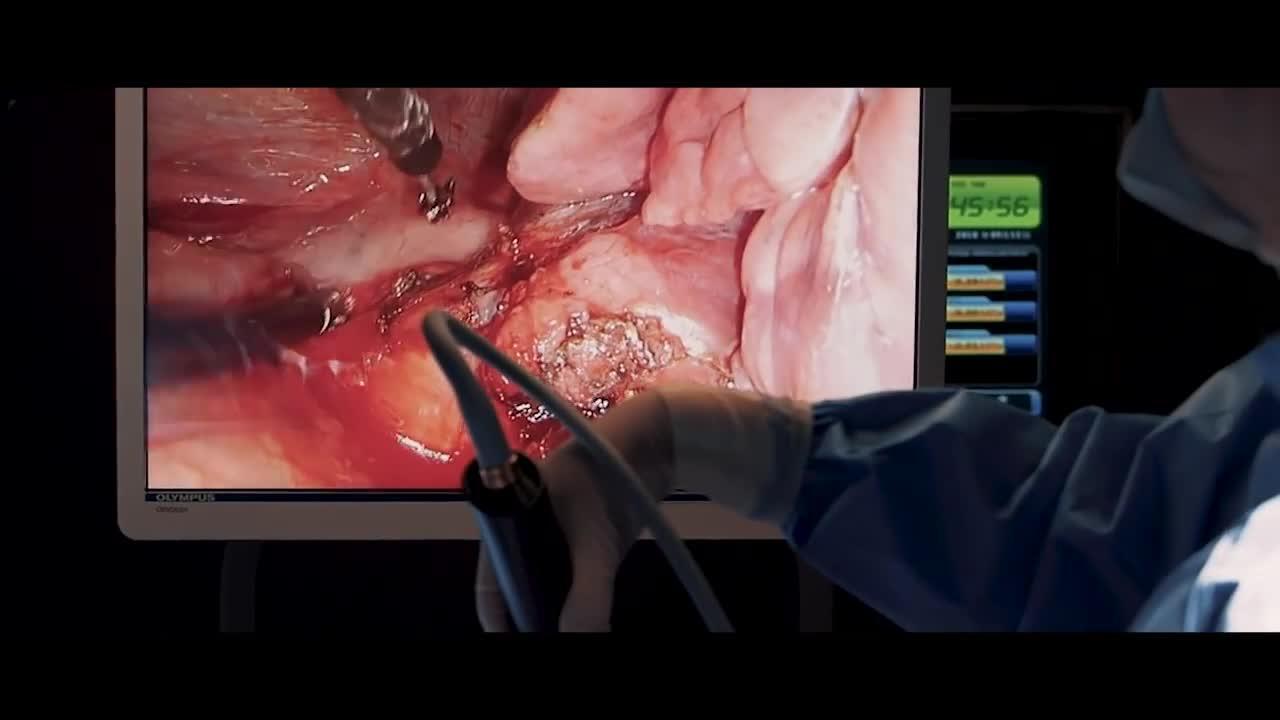 Video de Daniel López (Mandeo Records) en el Shanghai Pulmonary Hospital