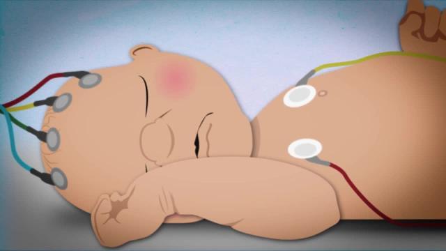 Un método no invasivo mide si los bebés tienen dolor