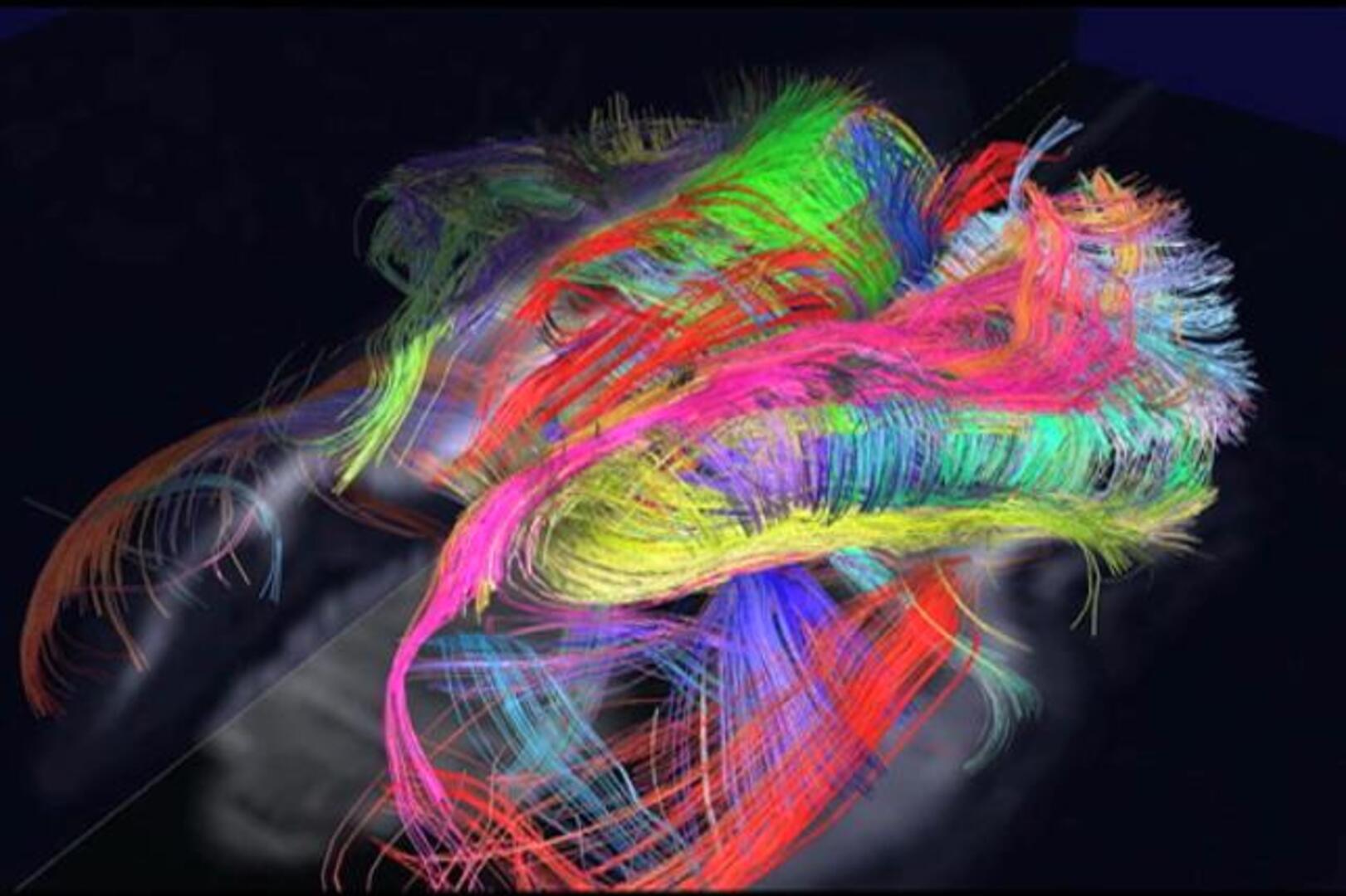 Completan el primer mapa del cerebro humano