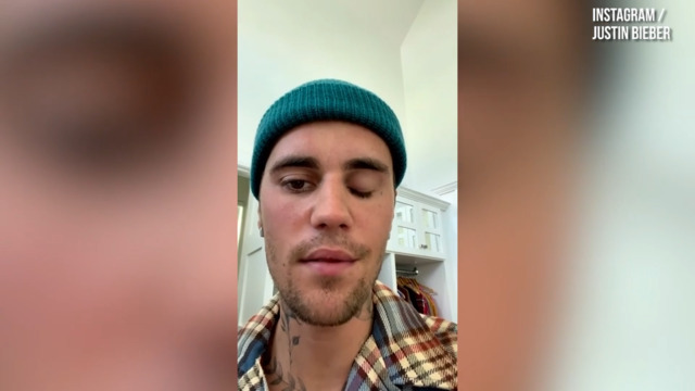 Justin Bieber Gives a Smiley Facial Mobility Update After Ramsay Hunt