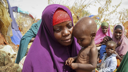 Starvation in Sudan 