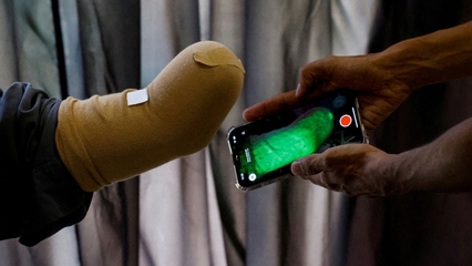 Netherlands accepts more Gaza patients: WHO denounces EU countries for not doing enough