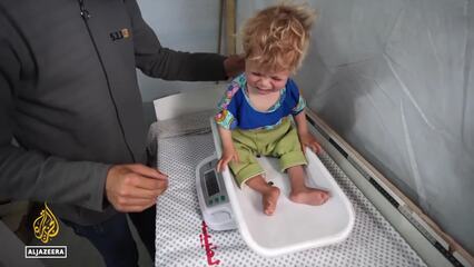 Gaza faces imminent famine: Children suffer the most from acute malnutrition
