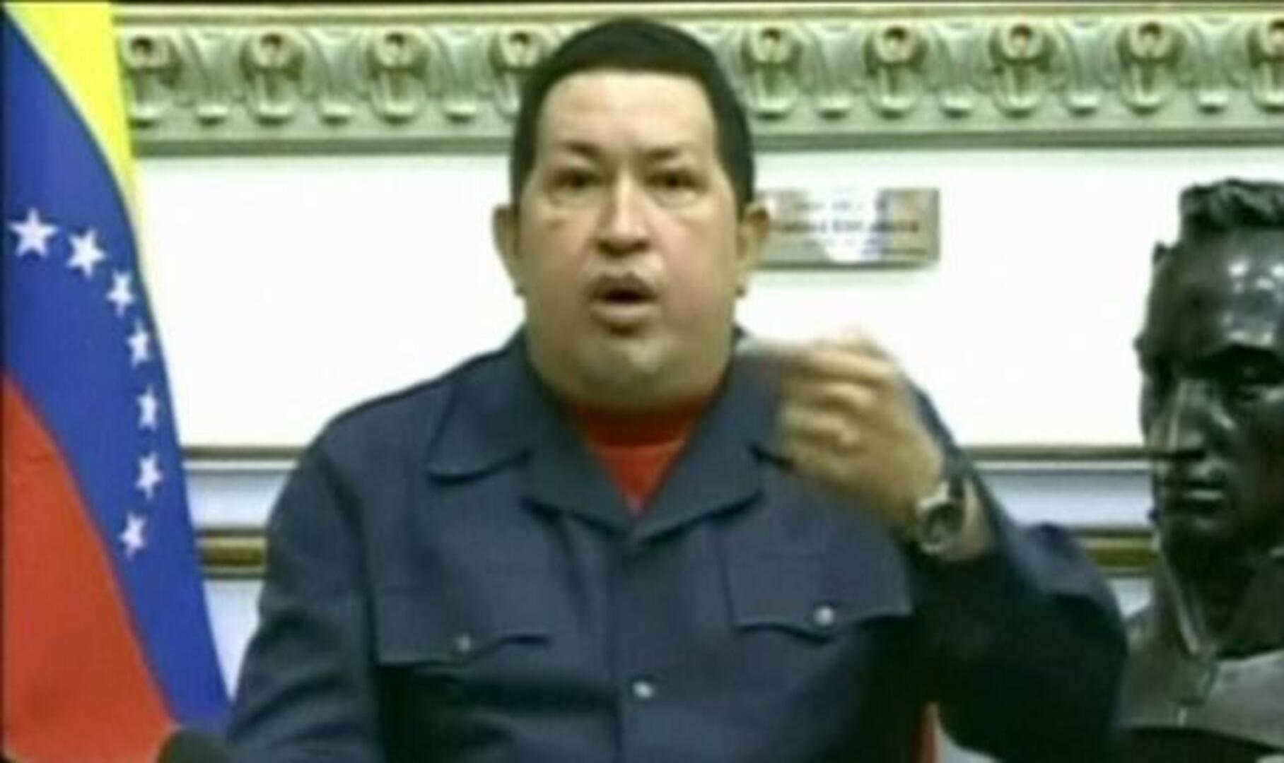 Hugo Chávez supera con éxito la operación